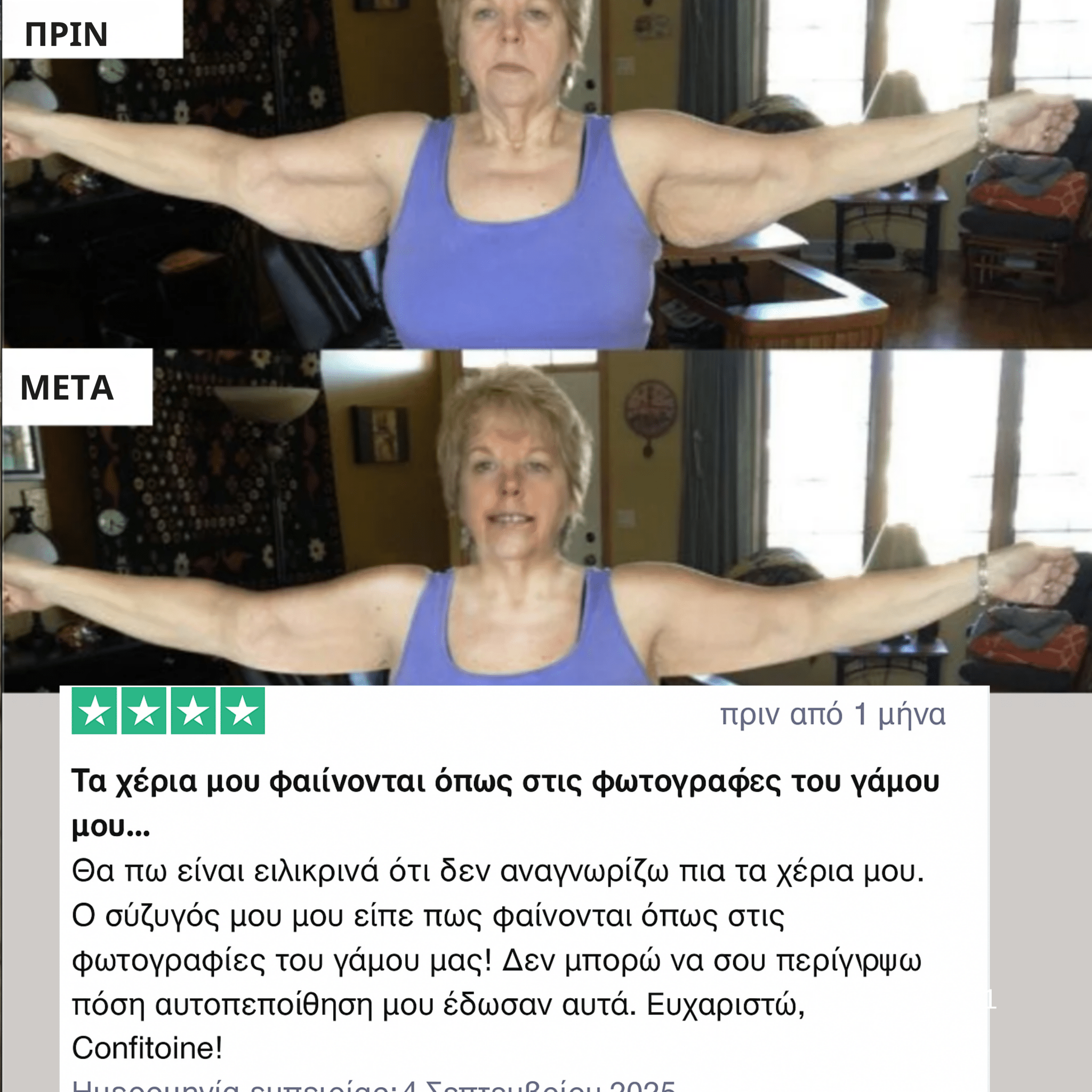 Kallisti - Θερμοτονικό Μανίκι Χεριών - Kallisti